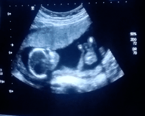 Screenshot_2018-03-06-08-32-27-1